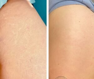 Screenshot_20250422_192904_Instagram