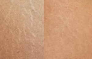 Screenshot_20250422_194311_Instagram